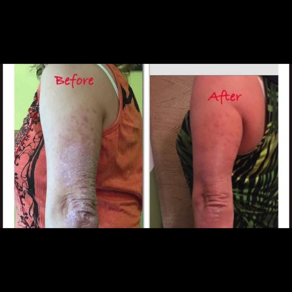 Body butter with tons of uses!! - Picture 6 of 6